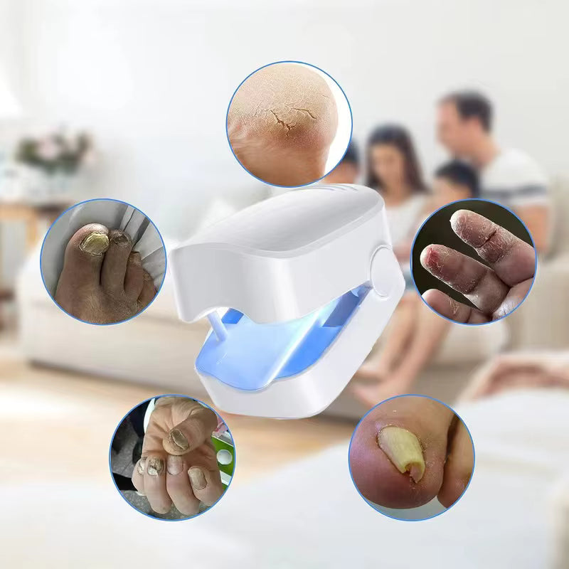 Appareil laser de classe I à usage domestique pour le traitement des mycoses des ongles des mains et des pieds et l'élimination de l'onychomycose